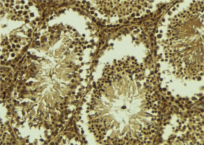 CENPU / MLF1IP Antibody - 1:100 staining mouse testis tissue by IHC-P. The sample was formaldehyde fixed and a heat mediated antigen retrieval step in citrate buffer was performed. The sample was then blocked and incubated with the antibody for 1.5 hours at 22°C. An HRP conjugated goat anti-rabbit antibody was used as the secondary.
