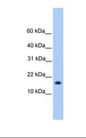 CENPW / C6orf173 Antibody - Hela cell lysate. Antibody concentration: 1.0 ug/ml. Gel concentration: 12%.  This image was taken for the unconjugated form of this product. Other forms have not been tested.