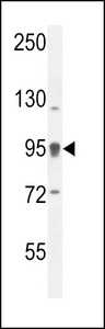 CENTB1 / ACAP1 Antibody - ACAP1 Antibody western blot of ZR-75-1 cell line lysates (35 ug/lane). The ACAP1 antibody detected the ACAP1 protein (arrow).
