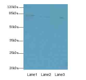 CENTB1 / ACAP1 Antibody - Western blot. All lanes: ACAP1 antibody at 4 ug/ml. Lane 1: Mouse lung tissue. Lane 2: Jurkat whole cell lysate. Lane 3: K562 whole cell lysate. Secondary Goat polyclonal to Rabbit IgG at 1:10000 dilution. Predicted band size: 82 kDa. Observed band size: 82 kDa.