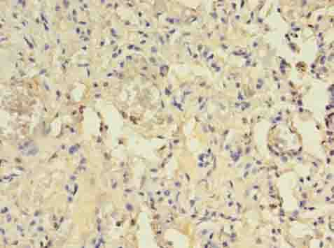 CENTB1 / ACAP1 Antibody - Immunohistochemistry of paraffin-embedded human lung tissue using antibody at dilution of 1:100.