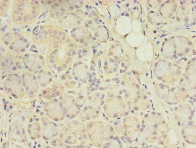 CENTB1 / ACAP1 Antibody - Immunohistochemistry of paraffin-embedded human pancreatic tissue using ACAP1 Antibody at dilution of 1:100