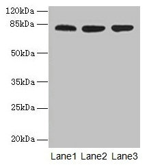 CENTB1 / ACAP1 Antibody - Western blot All lanes: ACAP1 antibody at 4µg/ml Lane 1: Mouse lung tissue Lane 2: Jurkat whole cell lysate Lane 3: K562 whole cell lysate Secondary Goat polyclonal to rabbit IgG at 1/10000 dilution Predicted band size: 82 kDa Observed band size: 82 kDa