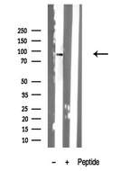 CENTB1 / ACAP1 Antibody - Western blot analysis of extracts of mouse lung tissue sample using Centaurin 1 antibody.