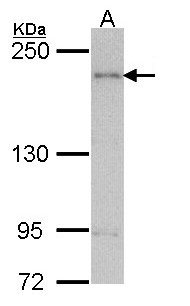 CENTD2 / ARAP1 Antibody - Sample (30 ug of whole cell lysate). A: H1299. 5% SDS PAGE. CENTD2 / ARAP1 antibody diluted at 1:1000.