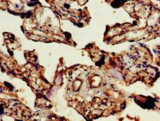 CENTD2 / ARAP1 Antibody - Immunohistochemistry of paraffin-embedded human placenta tissue at dilution of 1:100