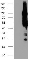 CENTG2 / AGAP1 Antibody - HEK293T cells were transfected with the pCMV6-ENTRY control (Left lane) or pCMV6-ENTRY AGAP1 (Right lane) cDNA for 48 hrs and lysed. Equivalent amounts of cell lysates (5 ug per lane) were separated by SDS-PAGE and immunoblotted with anti-AGAP1.