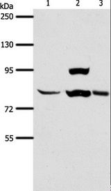 CENTG2 / AGAP1 Antibody - Western blot analysis of Human liver cancer tissue, HeLa cell and mouse lung tissue, using AGAP1 Polyclonal Antibody at dilution of 1:400.