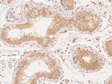CENTG2 / AGAP1 Antibody - Immunochemical staining of human AGAP1 in human testis with rabbit polyclonal antibody at 1:100 dilution, formalin-fixed paraffin embedded sections.