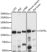 CEP1 / Centriolin Antibody - Western blot analysis of extracts of various cell lines, using CNTRL antibody at 1:1000 dilution. The secondary antibody used was an HRP Goat Anti-Rabbit IgG (H+L) at 1:10000 dilution. Lysates were loaded 25ug per lane and 3% nonfat dry milk in TBST was used for blocking. An ECL Kit was used for detection and the exposure time was 5s.