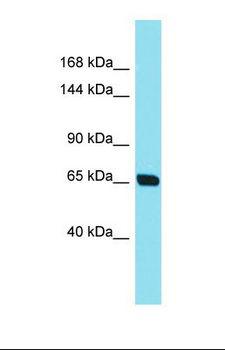 CEP104 Antibody - Western blot of Human 721_B. CEP104 antibody dilution 1.0 ug/ml.  This image was taken for the unconjugated form of this product. Other forms have not been tested.