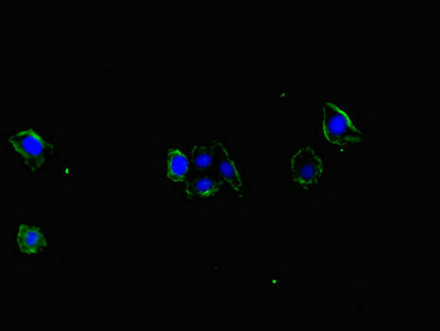 CEP104 Antibody - Immunofluorescent analysis of HepG2 cells diluted at 1:100 and Alexa Fluor 488-congugated AffiniPure Goat Anti-Rabbit IgG(H+L)