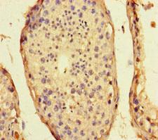 CEP104 Antibody - Immunohistochemistry of paraffin-embedded human testis tissue at dilution of 1:100