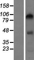 CEP104 Protein - Western validation with an anti-DDK antibody * L: Control HEK293 lysate R: Over-expression lysate