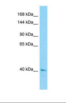 CEP120 Antibody - Western blot of Human ACHN. CEP120 antibody dilution 1.0 ug/ml.  This image was taken for the unconjugated form of this product. Other forms have not been tested.