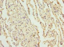 CEP120 Antibody - Immunohistochemistry of paraffin-embedded human lung tissue at dilution 1:100
