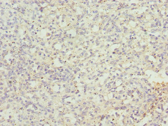 CEP120 Antibody - Immunohistochemistry of paraffin-embedded human spleen tissue at dilution 1:100