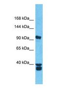 CEP131 / AZI1 Antibody - Western blot of AZI1 Antibody with human COLO205 Whole Cell lysate.  This image was taken for the unconjugated form of this product. Other forms have not been tested.