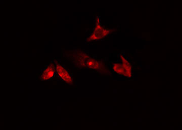 CEP131 / AZI1 Antibody - Staining HuvEc cells by IF/ICC. The samples were fixed with PFA and permeabilized in 0.1% Triton X-100, then blocked in 10% serum for 45 min at 25°C. The primary antibody was diluted at 1:200 and incubated with the sample for 1 hour at 37°C. An Alexa Fluor 594 conjugated goat anti-rabbit IgG (H+L) antibody, diluted at 1/600, was used as secondary antibody.