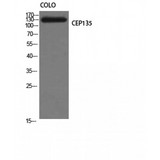 CEP135 Antibody - Western blot of CEP135 antibody