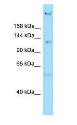CEP135 Antibody - CEP135 antibody Western Blot of A549.  This image was taken for the unconjugated form of this product. Other forms have not been tested.