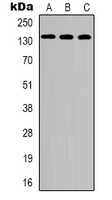 CEP135 Antibody - Western blot analysis of CEP135 expression in HEK293T (A); mouse lung (B); mouse heart (C) whole cell lysates.