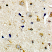 CEP135 Antibody - Immunohistochemical analysis of CEP135 staining in human brain formalin fixed paraffin embedded tissue section. The section was pre-treated using heat mediated antigen retrieval with sodium citrate buffer (pH 6.0). The section was then incubated with the antibody at room temperature and detected with HRP and DAB as chromogen. The section was then counterstained with hematoxylin and mounted with DPX.