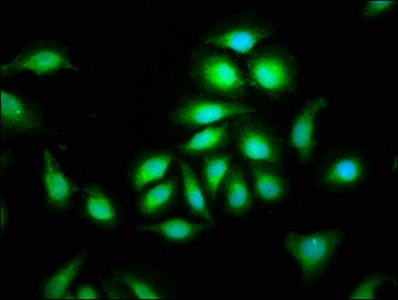 CEP135 Antibody - Immunofluorescence staining of A549 cells at a dilution of 1:100, counter-stained with DAPI. The cells were fixed in 4% formaldehyde, permeabilized using 0.2% Triton X-100 and blocked in 10% normal Goat Serum. The cells were then incubated with the antibody overnight at 4 °C.The secondary antibody was Alexa Fluor 488-congugated AffiniPure Goat Anti-Rabbit IgG (H+L) .