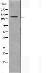 CEP135 Antibody - Western blot analysis of extracts of COLO cells using CEP135 antibody.
