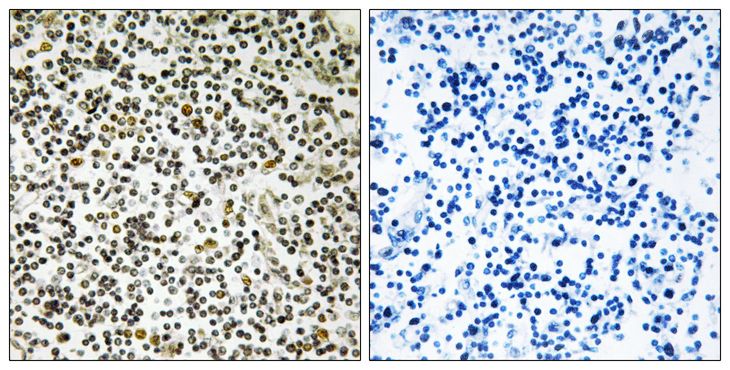 CEP152 Antibody - Immunohistochemistry analysis of paraffin-embedded human lymph node tissue, using CEP152 Antibody. The picture on the right is blocked with the synthesized peptide.