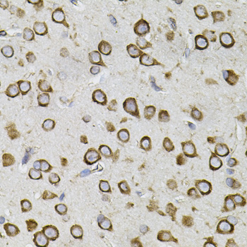 CEP164 Antibody - Immunohistochemistry of paraffin-embedded mouse brain tissue.