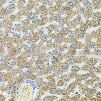 CEP164 Antibody - Immunohistochemistry of paraffin-embedded rat liver tissue.