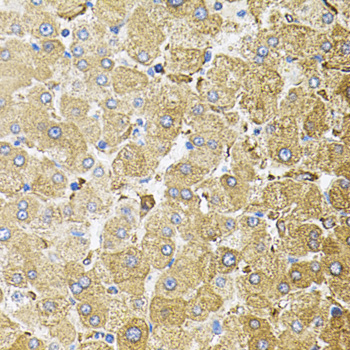 CEP164 Antibody - Immunohistochemistry of paraffin-embedded human liver injury tissue.