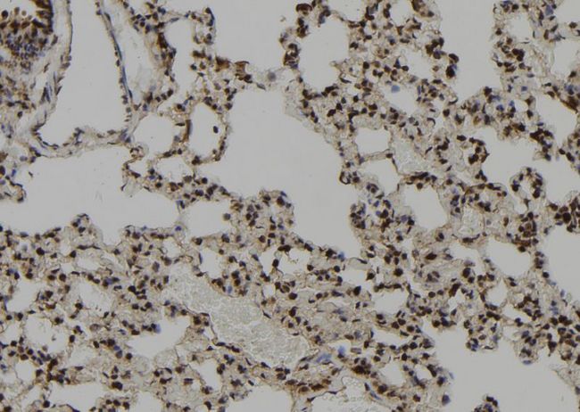 CEP164 Antibody - 1:100 staining rat lung tissue by IHC-P. The sample was formaldehyde fixed and a heat mediated antigen retrieval step in citrate buffer was performed. The sample was then blocked and incubated with the antibody for 1.5 hours at 22°C. An HRP conjugated goat anti-rabbit antibody was used as the secondary.