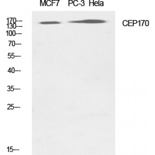 CEP170 Antibody - Western blot of CEP170 antibody