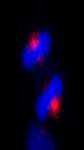 CEP170 Antibody - Detection of Human CEP170 by Immunocytochemistry. Sample: NBF-fixed asynchronous HeLa cells. Antibody: Affinity purified rabbit anti-CEP170 used at a dilution of 1:200. Detection: Red-fluorescent goat anti-rabbit IgG highly cross-adsorbed Antibody used at a dilution of 1:100.
