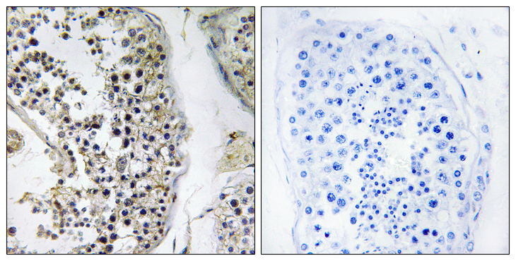 CEP170 Antibody - Immunohistochemistry analysis of paraffin-embedded human testis tissue, using CEP170 Antibody. The picture on the right is blocked with the synthesized peptide.