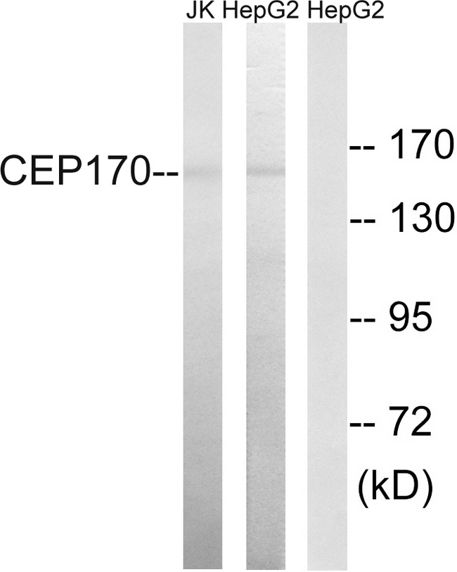 CEP170 Antibody - Western blot analysis of lysates from HepG2 and Jurkat cells, using CEP170 Antibody. The lane on the right is blocked with the synthesized peptide.