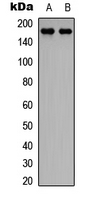CEP170 Antibody - Western blot analysis of CEP170 expression in HeLa (A); Jurkat (B) whole cell lysates.