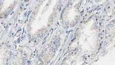 CEP170 Antibody - 1:100 staining human prostate tissue by IHC-P. The sample was formaldehyde fixed and a heat mediated antigen retrieval step in citrate buffer was performed. The sample was then blocked and incubated with the antibody for 1.5 hours at 22°C. An HRP conjugated goat anti-rabbit antibody was used as the secondary.