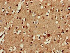CEP19 / C3orf34 Antibody - Immunohistochemistry of paraffin-embedded human brain tissue at dilution of 1:100