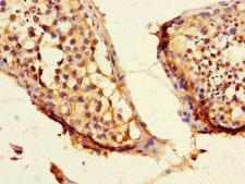 CEP192 Antibody - Immunohistochemistry of paraffin-embedded human testicular tissue using CEP192 Antibody at dilution of 1:100