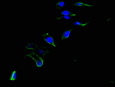 CEP192 Antibody - Immunofluorescent analysis of Hela cells using CEP192 Antibody at a dilution of 1:100 and Alexa Fluor 488-congugated AffiniPure Goat Anti-Rabbit IgG(H+L)