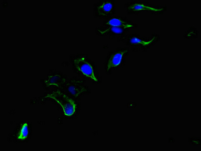 CEP192 Antibody - Immunofluorescent analysis of Hela cells using CEP192 Antibody at dilution of 1:100 and Alexa Fluor 488-congugated AffiniPure Goat Anti-Rabbit IgG(H+L)