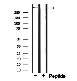 CEP250 / C-NAP1 Antibody - Western blot analysis of extracts of mouse brain tissue using CEP250 antibody.