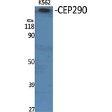CEP290 Antibody - Western blot of CEP290 antibody