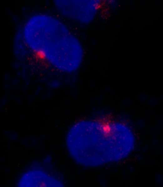 CEP290 Antibody - Detection of Human CEP290 by Immunocytochemistry. Sample: NBF-fixed asynchronous HeLa cells. Antibody: Affinity purified rabbit anti-CEP290 used at a dilution of 1:500. Detection: Red-fluorescent goat anti-rabbit IgG cross-adsorbed Antibody DyLight 594 (A120-601D4) used at a dilution of 1:100.
