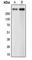 CEP290 Antibody - Western blot analysis of CEP290 expression in HeLa (A); CCRFCEM (B) whole cell lysates.