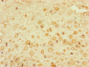 CEP290 Antibody - Immunohistochemistry of paraffin-embedded human placenta tissue at dilution of 1:100