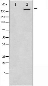 CEP290 Antibody - Western blot analysis of extracts of K562 cells using CEP290 antibody. The lane on the left is treated with the antigen-specific peptide.